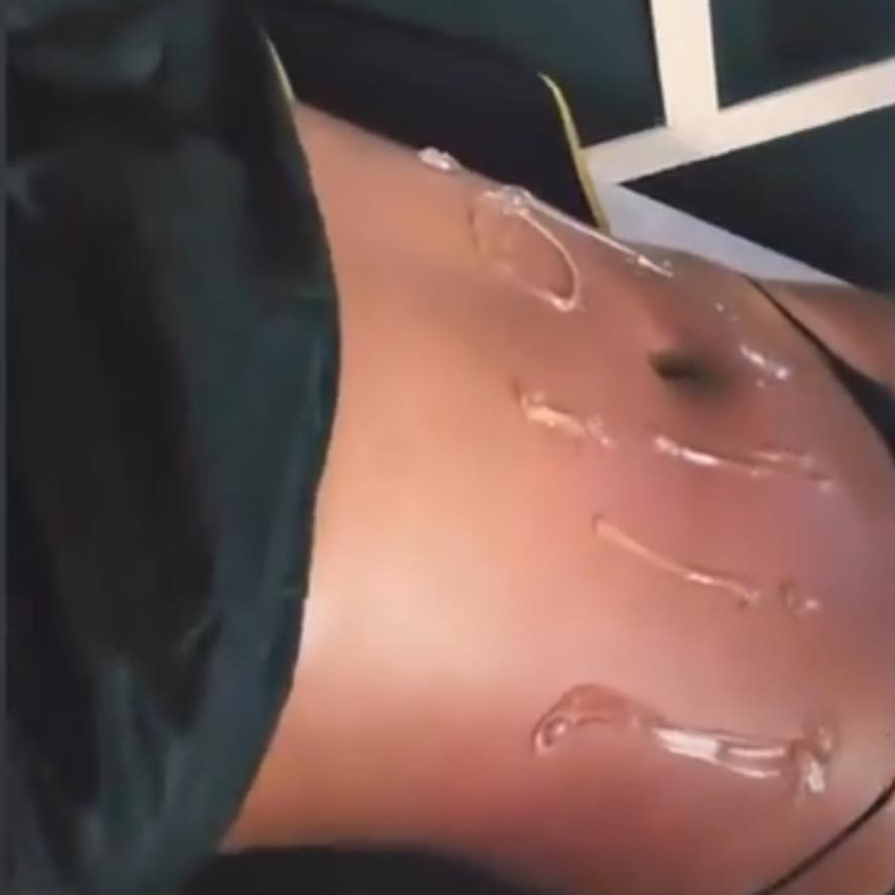 Non-invasive Body Contouring Membership