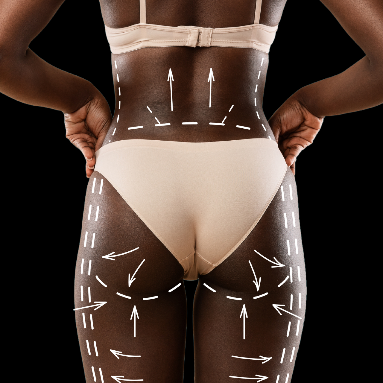 Lemon Lipo (Lemon Drop) Membership