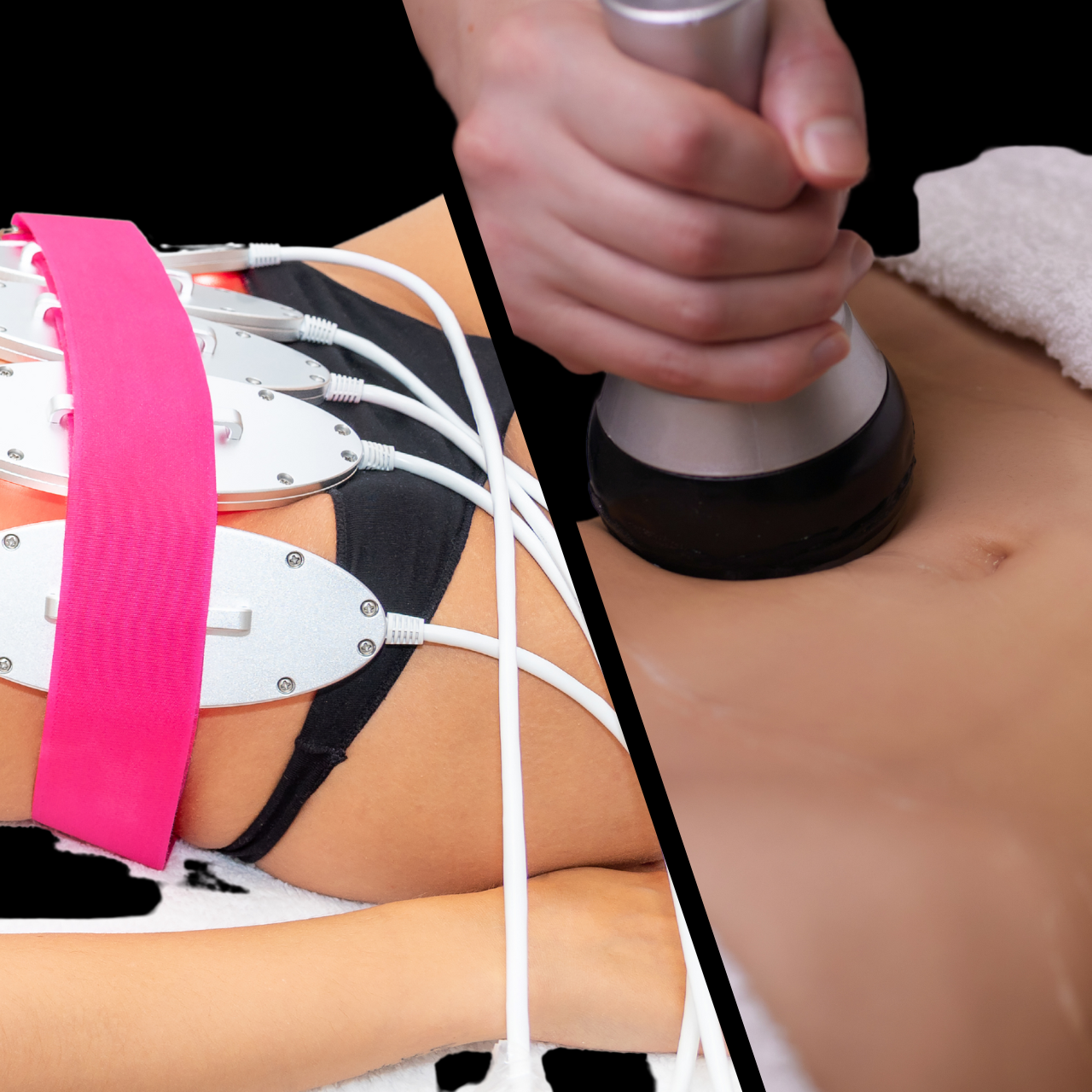 Laser lipo with cavitation